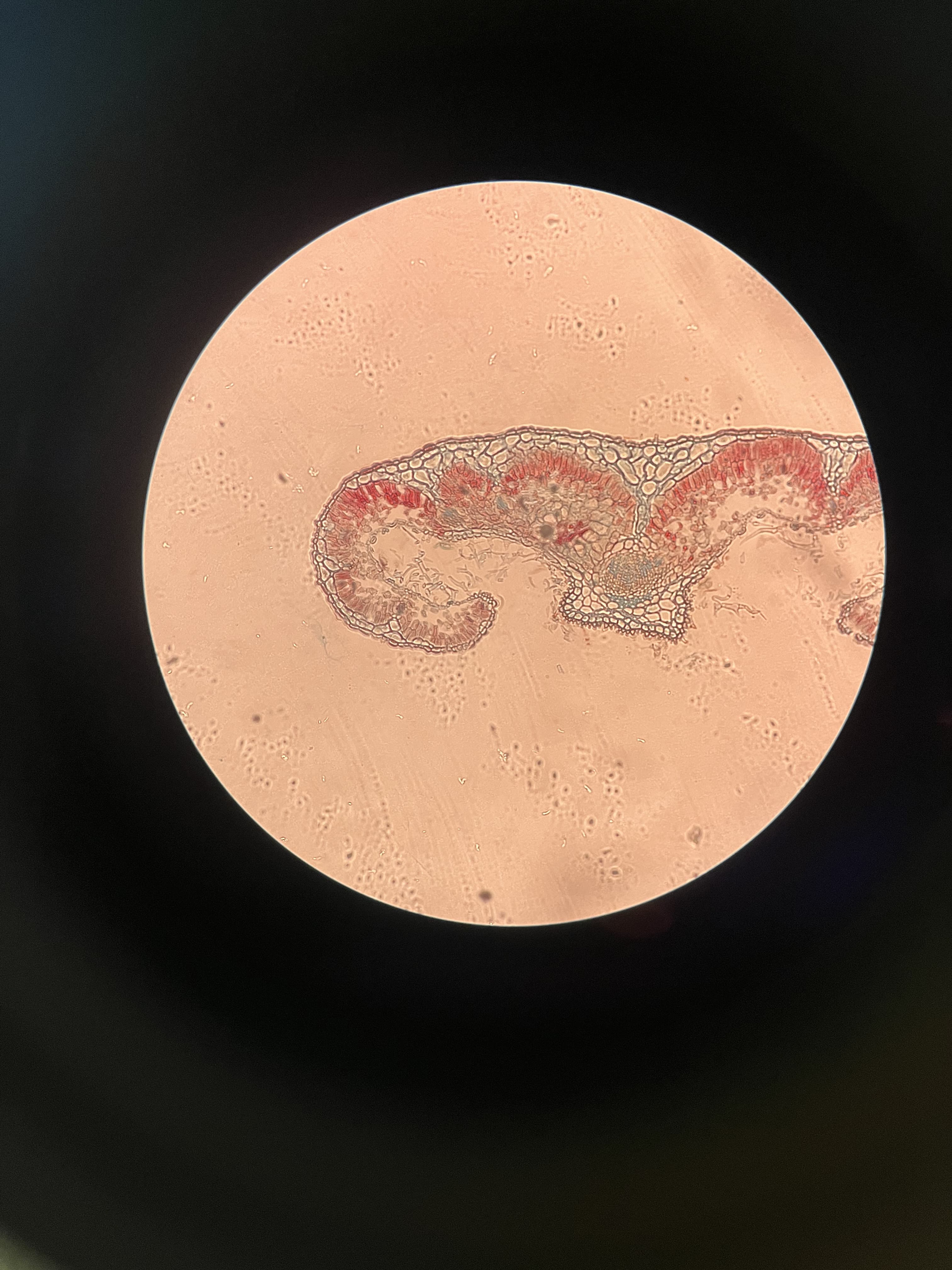 Tissue specimen under the microscope